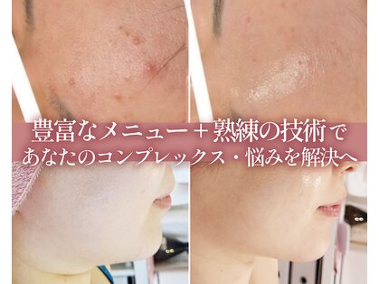 AK エステティックス(AK Esthetics)の写真