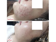 ミュー(Mieux)/大事な日のため頑張ってよかった