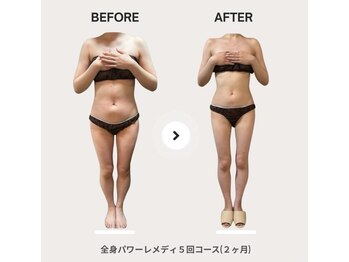 ビループ(biloop)/今年中に変わりたい方はbiloopへ