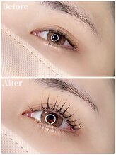 レピア 郡山駅前店/韓国式LEPIA Before&After