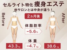 ラ パルレ 富山店/全身セルライトケア