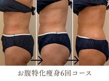 シーズ/ビフォーアフターその3