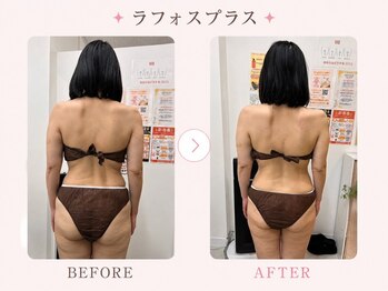 パールプラス 大垣店(Pearl plus)/肩こり/腰痛/姿勢/巻肩改善