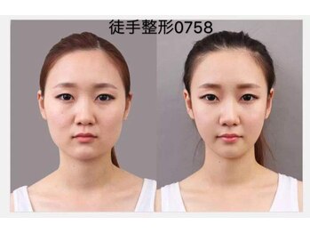 幸永院 川口店の写真/短時間一度でも驚きの激変！たるみ,むくみ,歪み,エラ,ほうれい線,面長,丸顔改善♪サイズ&美肌変化に驚愕！