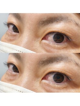 モードケイズ マノン(MODE K's MANON)/アイラッシュ