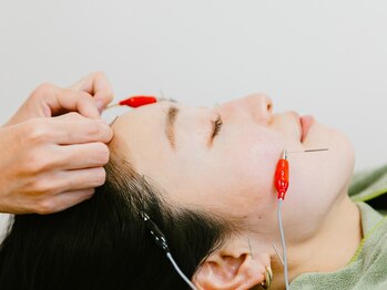 サワ きたざわ接骨院(sawa)/オーダーメイド美容鍼