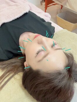 ヒーリングサロン アージュ(A-je)/★美顔鍼＋小顔矯正★