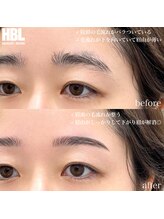 わたしいろ/HBLビフォーアフター