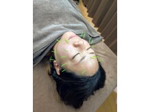のなか鍼灸院