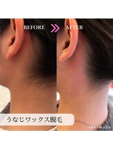 ココカナ(COCOKANA)/うなじミックス脱毛