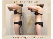 オキシー グレイス 黒崎店(OXY Grace)/インドリンパ痩身×キャビ