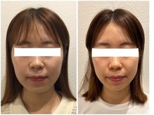 美容整体 ウェリナ 蟹江院/小顔矯正/骨盤矯正/美脚サロン 