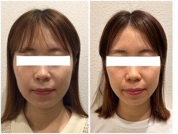 美容整体 ウェリナ 蟹江院/小顔矯正/骨盤矯正/美脚サロン 