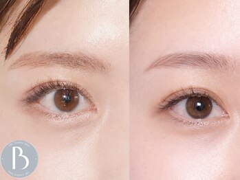 trois.［HBL/ハリウッドブロウ/眉毛/アイブロウ/フェイスワックス］【トロワ】の写真/HBL公式推奨サロンで叶える理想の眉。まだら・濃いなどのコンプレックスを解消して、自分史上最高の眉へ！