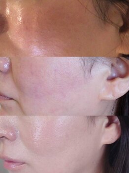 ベル(Belle)/赤み・トーンアップ改善