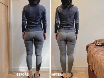 ラーナビコツ(RANA-bikotsu)の写真/矯正が初めての方にも◎肩こり・姿勢の悪さ・Ｏ脚に！骨盤ケアで軽やかな私へ♪