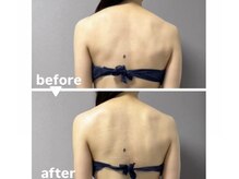 メゾン ド クロエ(Maison de Chloe)の雰囲気（【痩せただけでは叶わない】骨格×深層筋から整えます＊）
