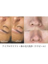 フィーネ アイブロウ(Fi-Ne)/眉毛＋鼻毛穴洗浄（ララピール）