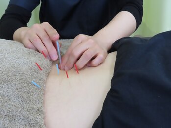 ふくみみ鍼灸接骨院/鍼灸