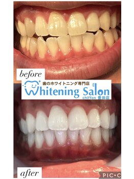 シフォン 豊田店/3週間通い放題フリーパスコース