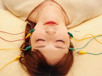 カエデ(Kaede)の写真/電気を通した極細鍼使用の≪美容鍼≫で効果バツグン◇顔のむくみ・ゆるんだフェイスラインを徹底改善◎