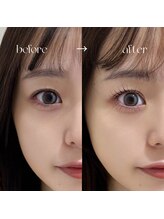 ガレリア アイデザイン 名駅店(GALLARIA Eye design)/＊ 上下lashlift ＊