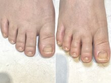 レヴィア(Revia)/