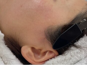 コロレ(colore)の写真/顔の産毛・角質除去で肌の悩みを解決！全顔Waxで叶う極上のツヤ肌へ♪