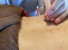 なかむら鍼灸院