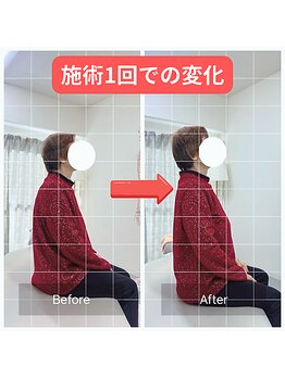 整体 寿 立川院(KOTOBUKI)/姿勢がキレイに!