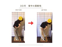 ストレッチ 整体 ホープ(HOPE)/30代からの背中柔軟性アップ