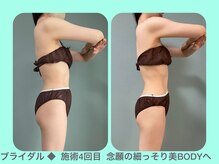 ビーナイス ビューティー(Be Nice Beauty)/◆ブライダル◆ ほっそり二の腕