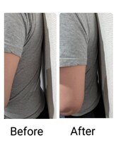 整体院 ケンケン/反り腰・猫背にオススメ