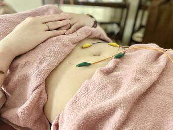 すまいる すとれーじ ともの写真/[酷使している体の頼れる味方]東洋学的視点で鍼灸施術を施し、あらゆる症状を根本改善！美容鍼&耳つぼも◎