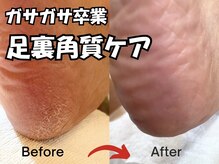 プラスワン(+1)