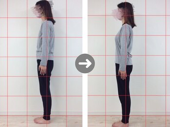 オーレ 秋葉原店(ole)/【小顔全身矯正コース10回】