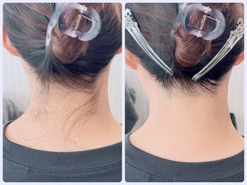 アロンジェファム(allonge femme)/【うなじ脱毛】都度払い1,900円