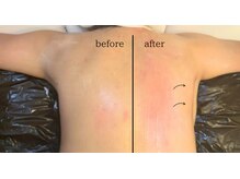 リンパ/オイル/腰痛/痩身/コルギ/よもぎ蒸し/肩こり/ヘッドスパ