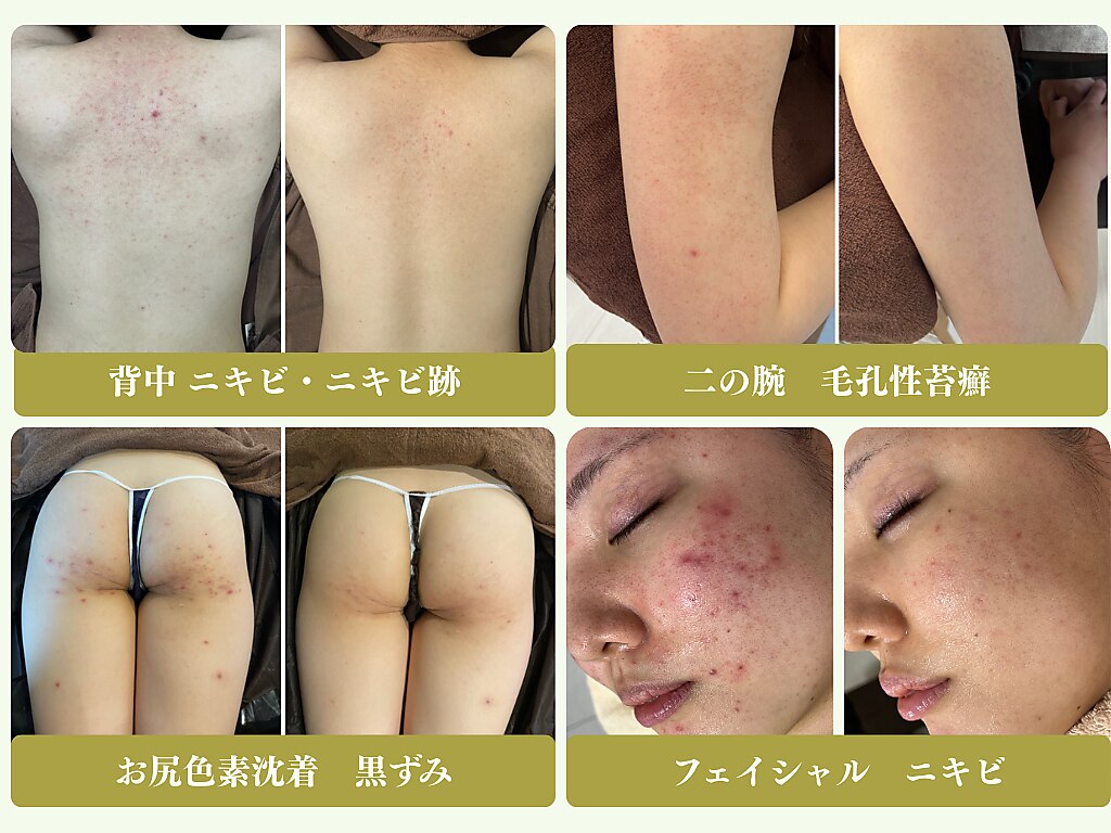 エミルカ 天王寺店(EMILUCA)｜ホットペッパービューティー