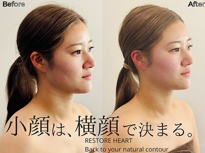 リストアハート(Restore Heart)の写真