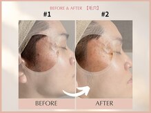 シンスプラス(SINCE+)/【メンズ専用】クリスティーナ