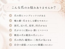 スティラ Stila 678の雰囲気（《長年の悩み解消》他店で断られた深爪、ダメージ爪も対応可◎）