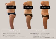 エーシーサロン 六本木店(acsalon)