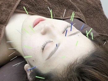 ビビオンリーワン 銀座築地(vivi only one)/vivi美容鍼コース