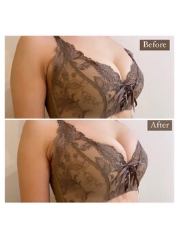 アンシャンテ(ENCHANTER)/光バストアップ