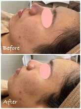 ロイ(Loy)/24/5/15のブログご覧ください♪