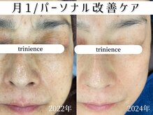 トリニエンス 新宿店(TRINIENCE)/50代/パーソナル改善ケア