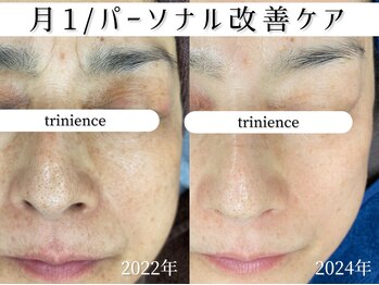 トリニエンス 新宿店(TRINIENCE)/50代/パーソナル改善ケア