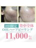 【ハーブピーリング・Lパーツ】美容液毛穴洗浄ハイドラ付11,000円