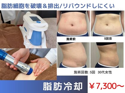エープラス(A+)の写真